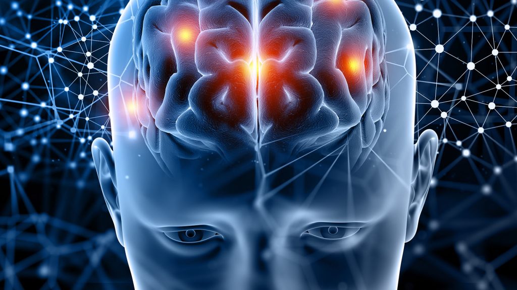 Brain resistance